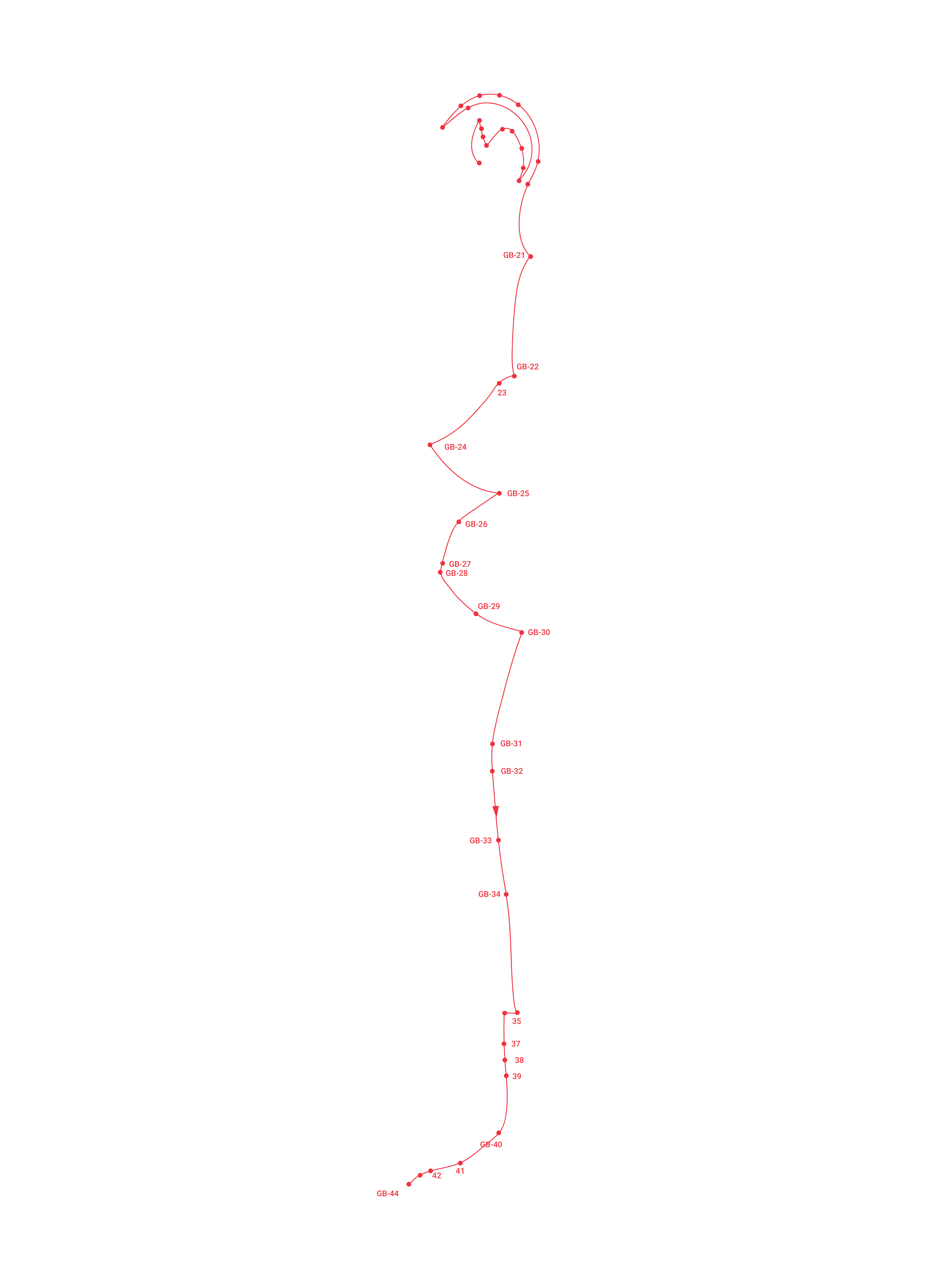 SideGallbladder